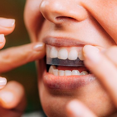 Closeup of patient putting on whitening strip