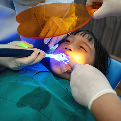 Young child having dental sealants placed by dentist