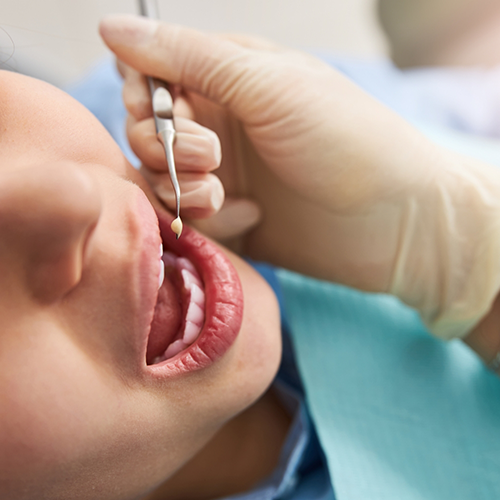Close up of patient's mouth during dental crown process