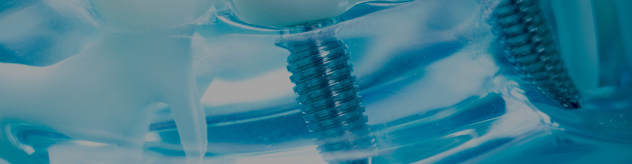 Close up of dental implant in Richardson