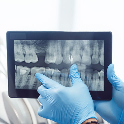 Dentist holding tablet showing X rays of teeth