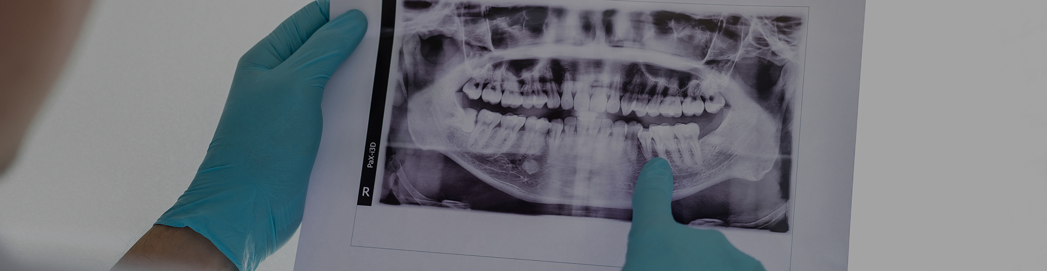 Dentist looking at X ray of teeth