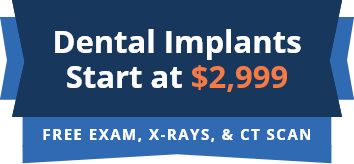 Dental Implants Special stamp
