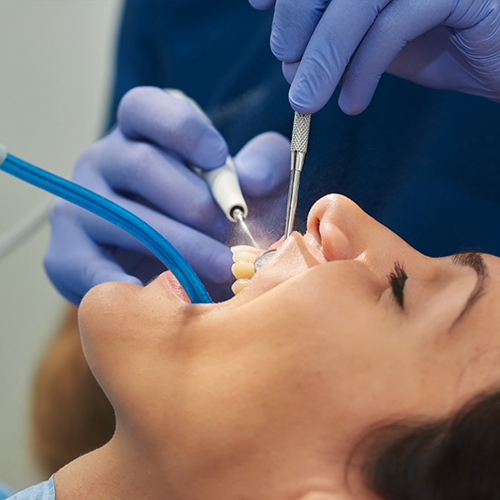 Woman holding mouth open for dental cleaning