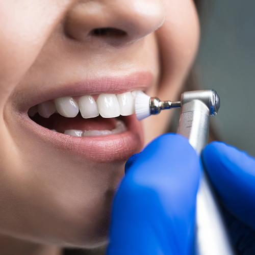 Close up of teeth being cleaned with powered dental brush