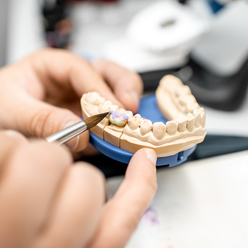 Close up of person working on dental restoration attached to model of teeth