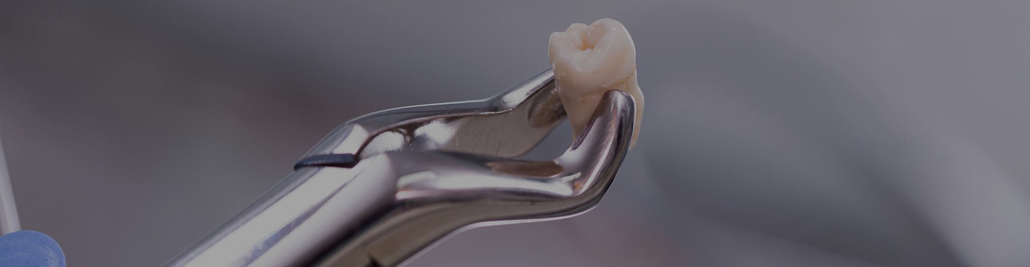 Close up of extracted tooth held by forceps