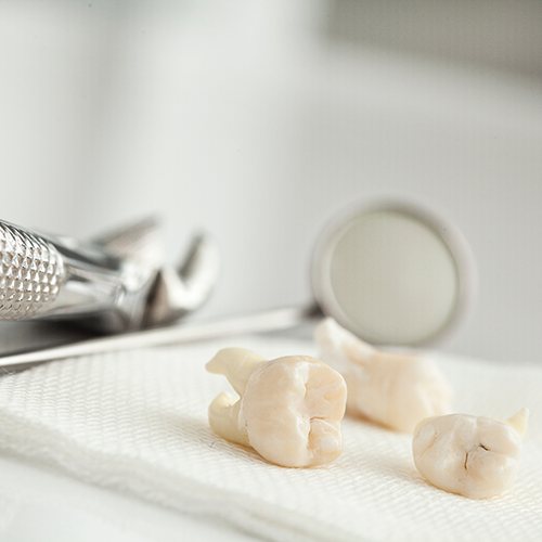 Teeth lying next to dental instruments after tooth extraction in Richardson