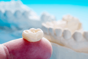 a close-up of a person holding a dental crown